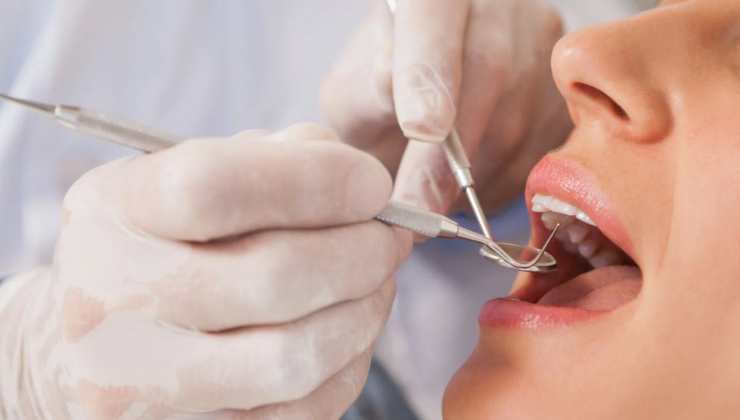 Come funziona il bonus dentista